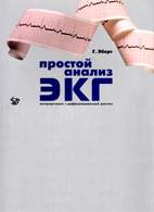 Простой анализ ЭКГ
